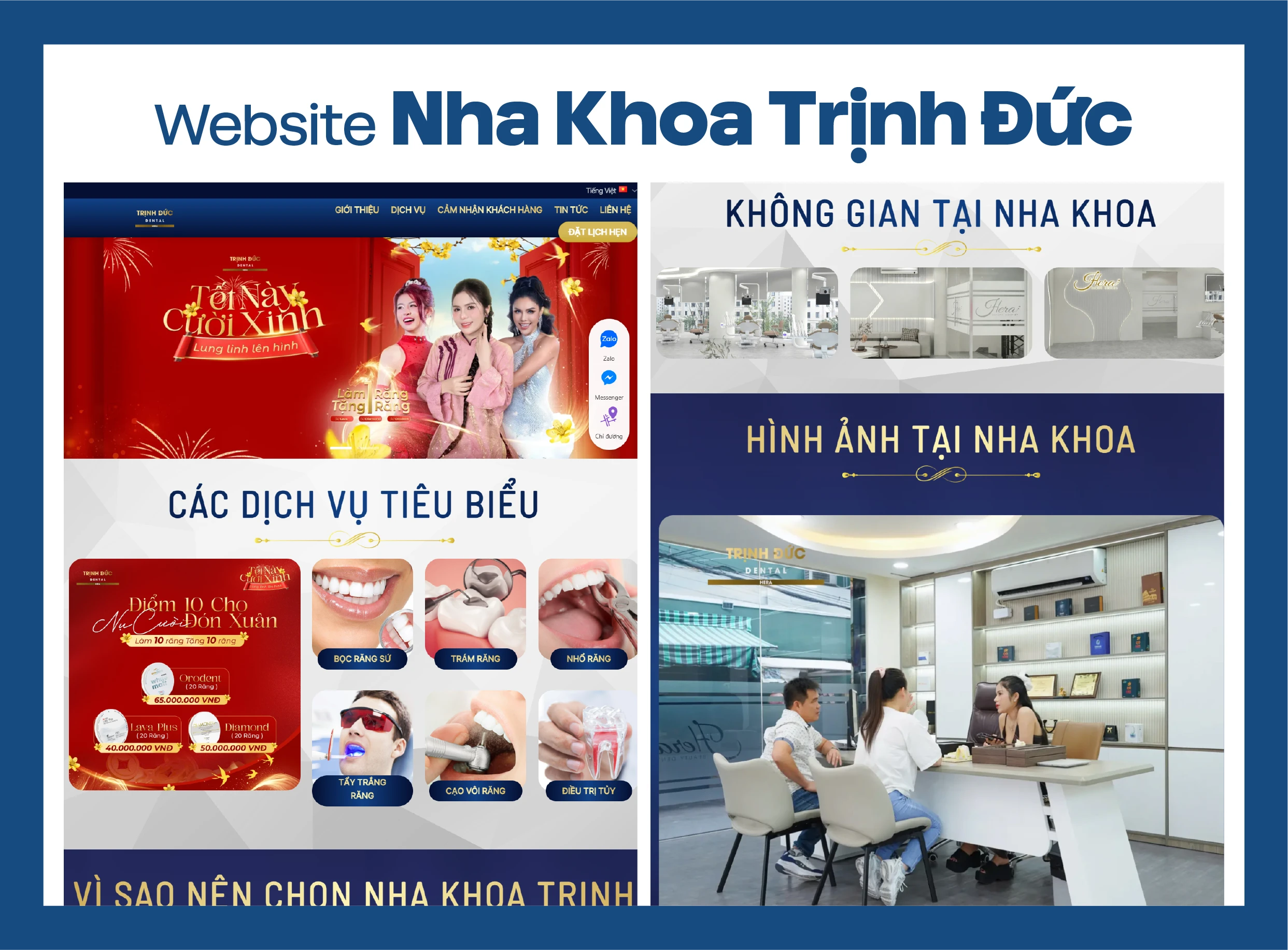 THIẾT KẾ WEBSITE